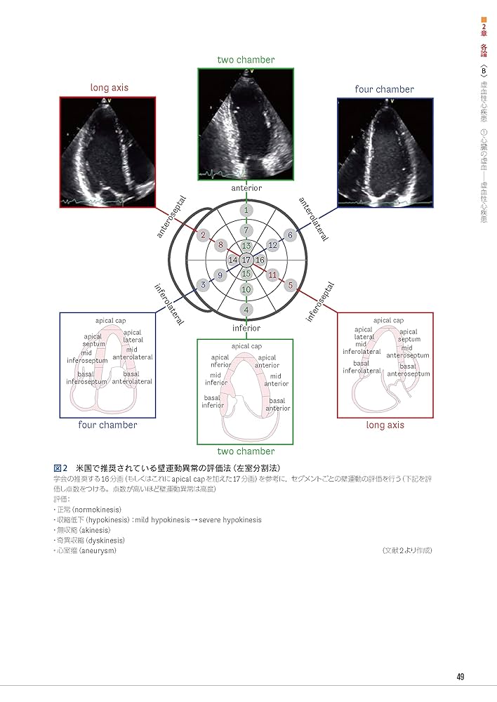 ❤️❤️❤️ER・ICUエコー活用術 : 何を見るか,どこまで見えるか ❤️❤️❤️ER・ICUエコー活用術 : 何を見るか,どこまで見える